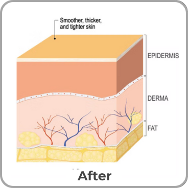 Microneedling 2 Before 2 Nail Salon near tilehurst
