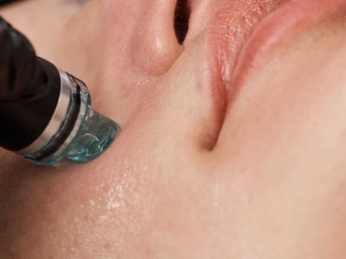 Hydrafacial