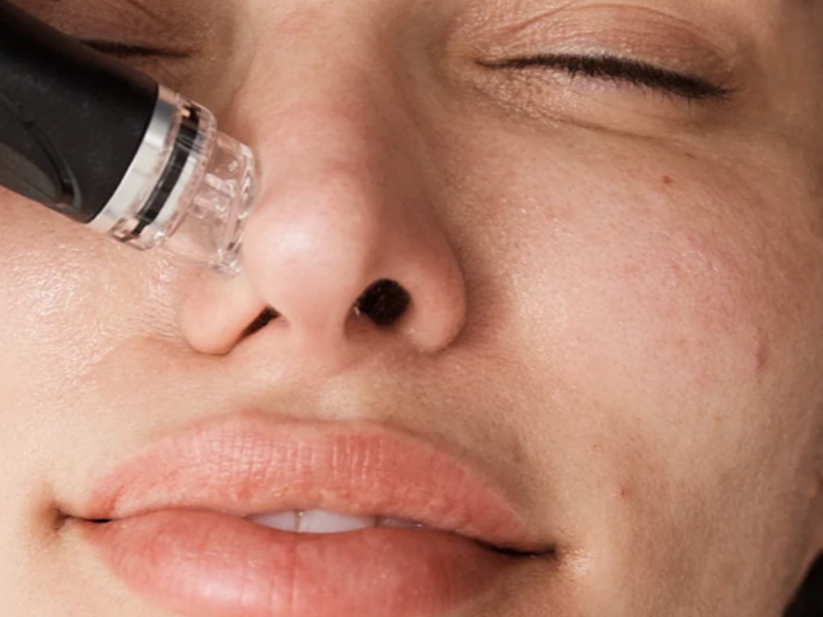 17 hydrafacial teaser 3 HydraFacial Pangbourne